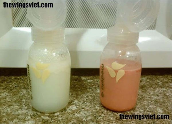 sữa mẹ có màu hồng cam