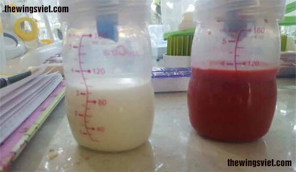 sữa mẹ màu sắc như thế nào
